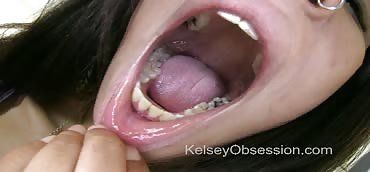 best of Exam mouth