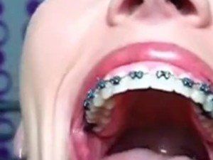 Camera inside mouth