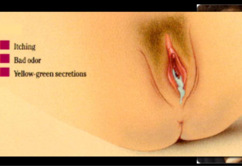 Vaginal discharge after orgasm